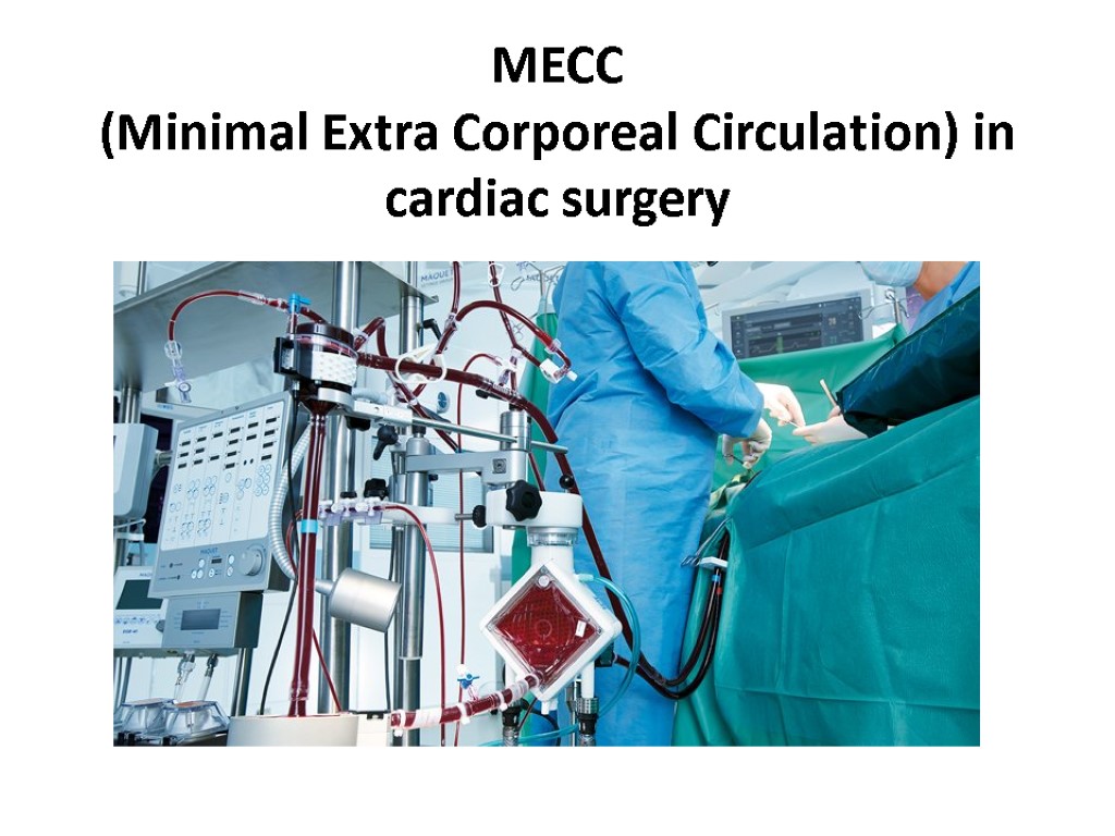 MECC (Minimal Extra Corporeal Circulation) in cardiac surgery